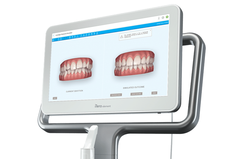 iTero Indigo Orthodontics in Columbia, SC