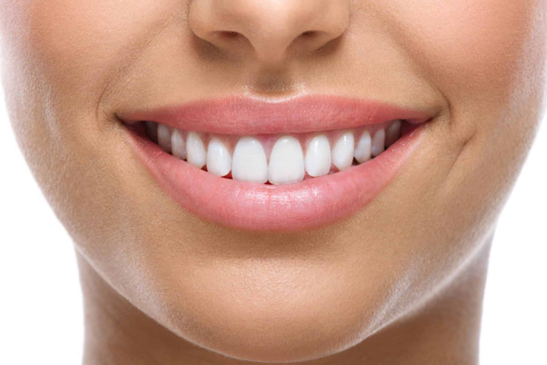 Retainers After Braces: How to Keep Your Best Smile  Indigo Orthodontics  Columbia, SC