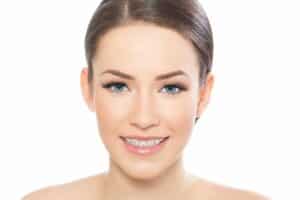 Key Milestones in Your Braces Journey Indigo Orthodontics in Columbia, SC