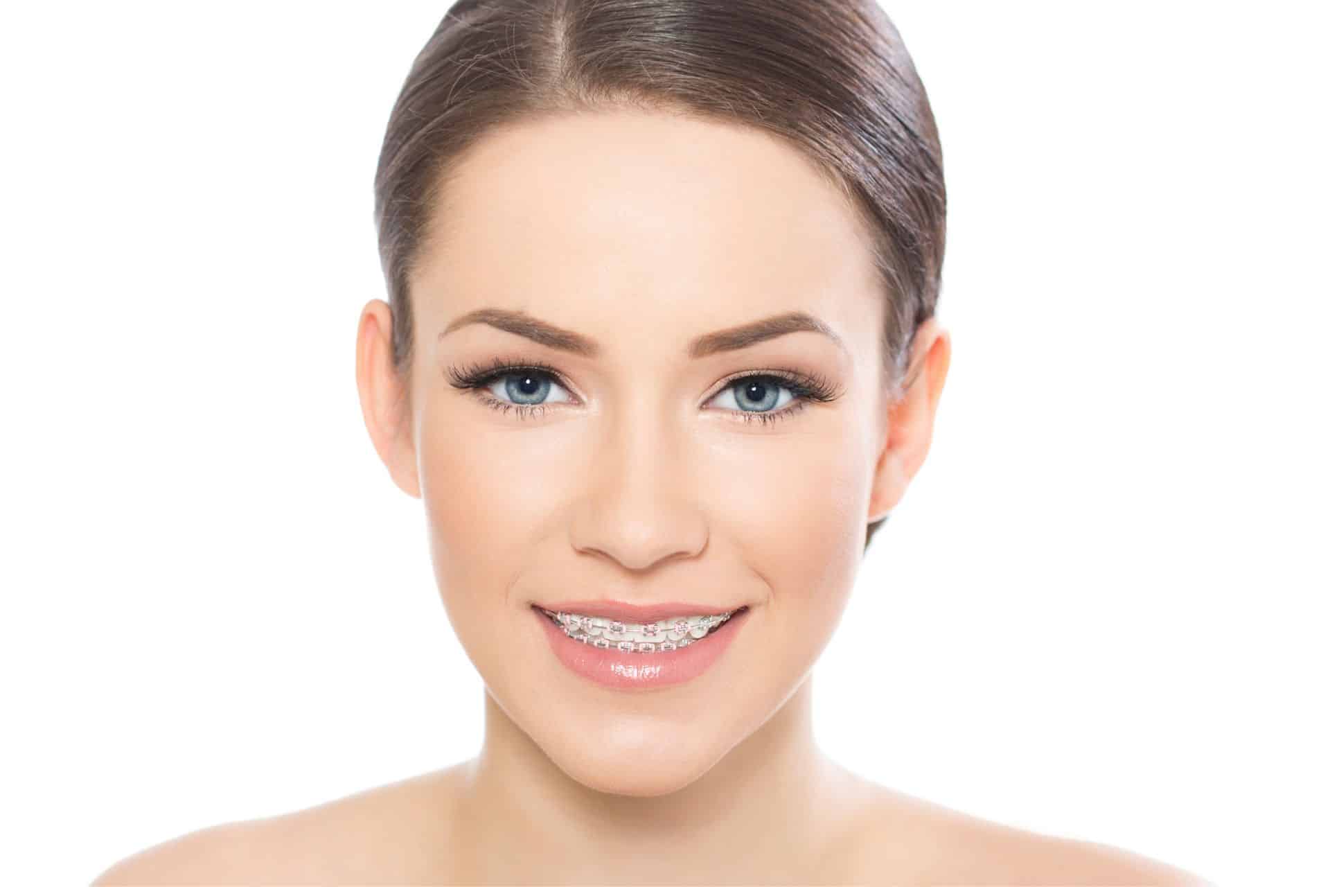 Key Milestones in Your Braces Journey Indigo Orthodontics in Columbia, SC